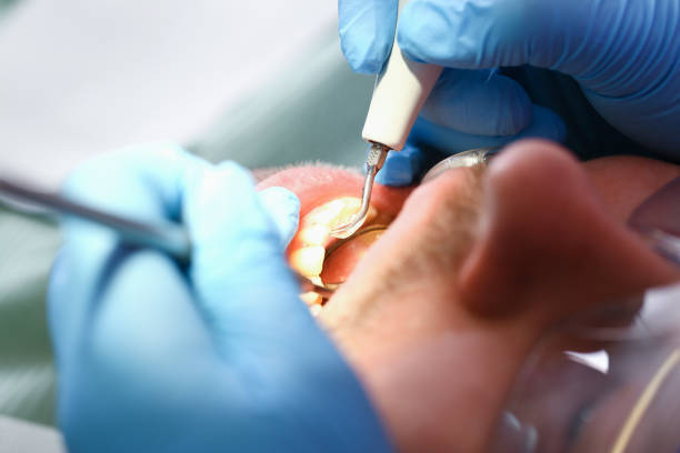 Best Urgent Dental Care for Toothache in Reese, MI