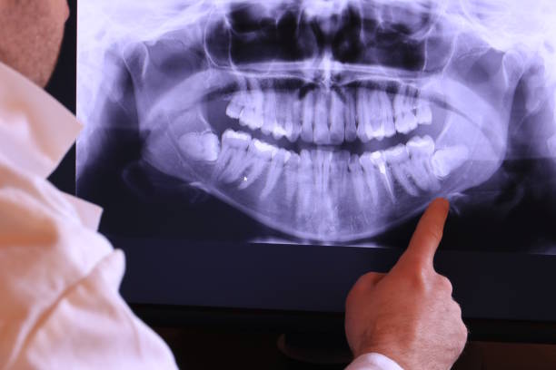 Best Mobile Emergency Dentist in Reese, MI