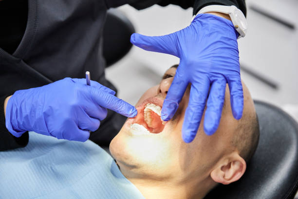Best Emergency Root Canal Treatment in Reese, MI